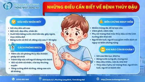 BÀI TUYÊN TRUYỀN PHÒNG CHỐNG DỊCH BỆNH THỦY ĐẬU